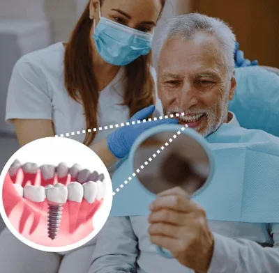 dental implants