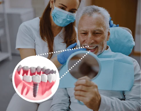 About Us dental implants