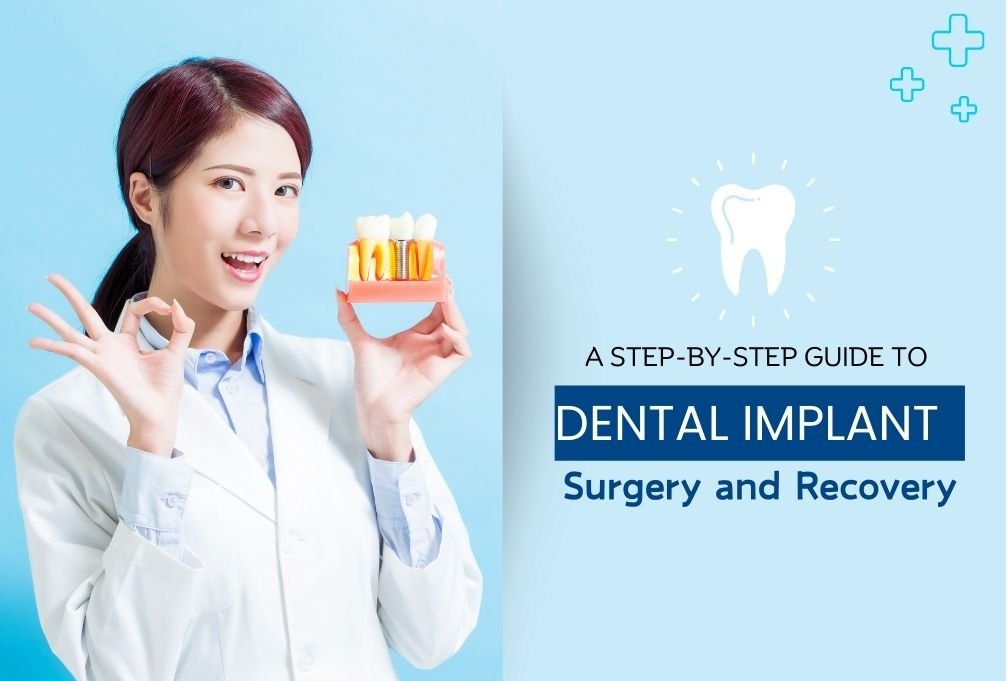 a step by step guide to dental implant surgery and recovery