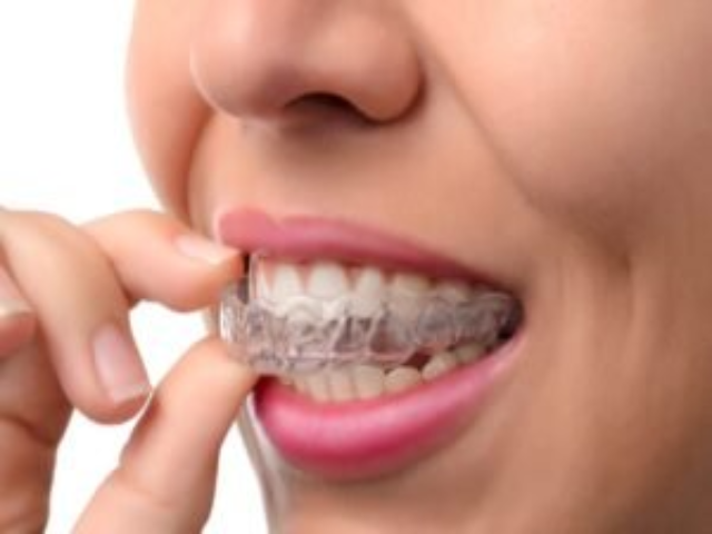 Orthodontics in McKinney, TX