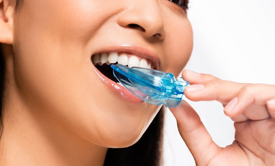 Orthodontics in McKinney, TX