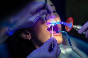 Laser Dentistry in Mckinney TX