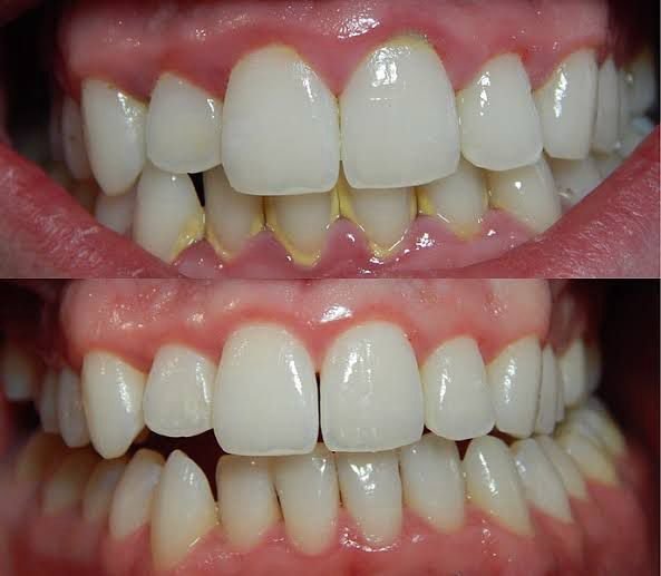Dental Exam in mckinney TX