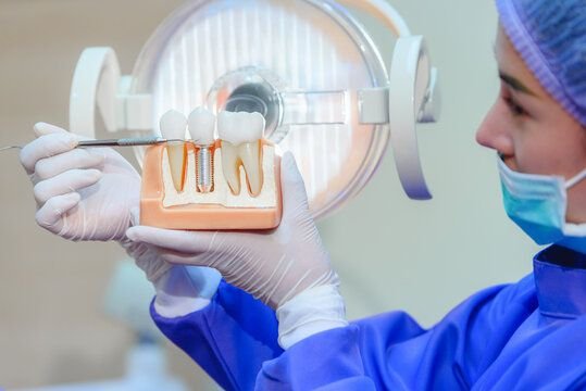 Dental Implant in Mckinney TX