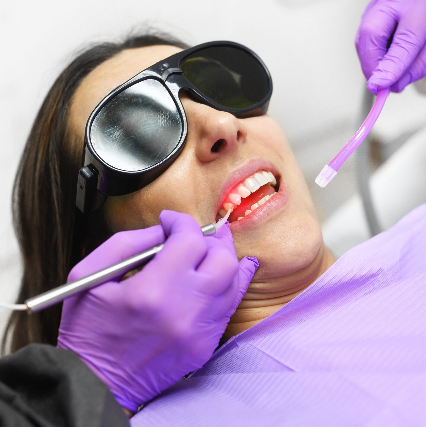Laser Dentistry in Mckinney TX