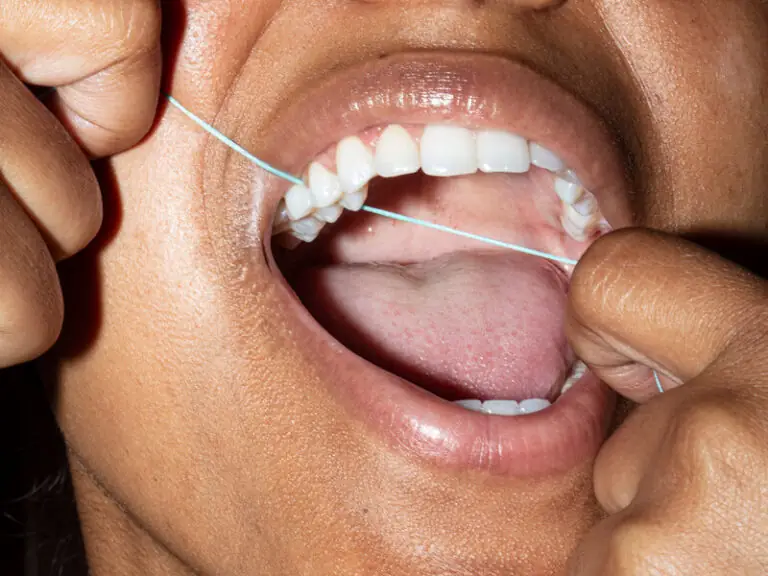 Protect Your Teeth from Acid Erosion