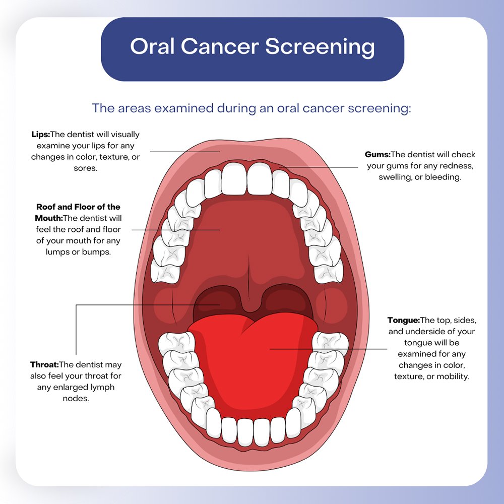 oral cancer screening