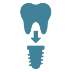 Implant restoration