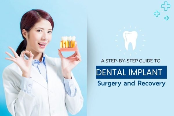 a step by step guide to dental implant surgery and recovery